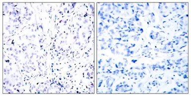 Anti-Rb antibody used in IHC (Paraffin sections) (IHC-P). GTX50459