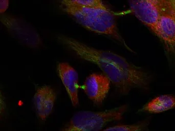 Anti-MEK3 antibody used in Immunocytochemistry/ Immunofluorescence (ICC/IF). GTX50464