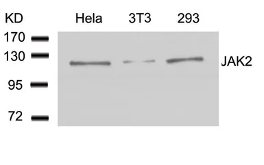 Anti-JAK2 antibody used in Western Blot (WB). GTX50467