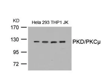 Anti-PKC mu antibody used in Western Blot (WB). GTX50472