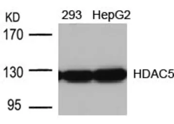 Anti-HDAC5 antibody used in Western Blot (WB). GTX50485