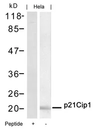 Anti-p21 Cip1 antibody used in Western Blot (WB). GTX50490