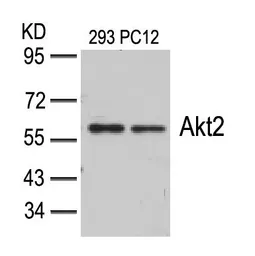 Anti-AKT2 antibody used in Western Blot (WB). GTX50494