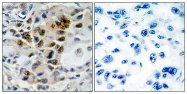 Anti-FOXO4 antibody used in IHC (Paraffin sections) (IHC-P). GTX50500