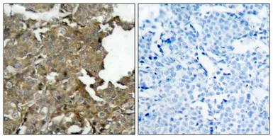Anti-Cofilin antibody used in IHC (Paraffin sections) (IHC-P). GTX50502