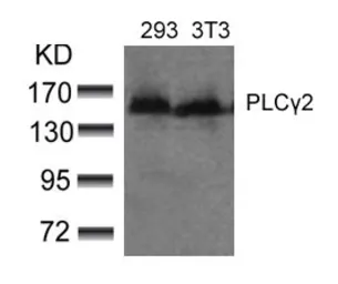 Anti-PLCG2 antibody used in Western Blot (WB). GTX50517