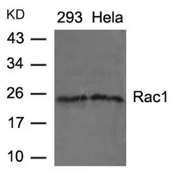 Anti-Rac1 antibody used in Western Blot (WB). GTX50530
