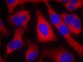 Anti-IRS1 antibody used in Immunocytochemistry/ Immunofluorescence (ICC/IF). GTX50550