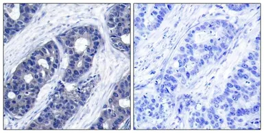 Anti-IRS1 antibody used in IHC (Paraffin sections) (IHC-P). GTX50550