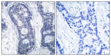Anti-eIF4E antibody used in IHC (Paraffin sections) (IHC-P). GTX50553