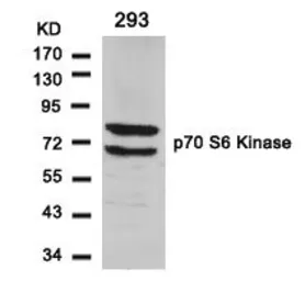 Anti-p70 S6K antibody used in Western Blot (WB). GTX50582