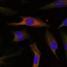 Anti-MAPKAPK-2 antibody used in Immunocytochemistry/ Immunofluorescence (ICC/IF). GTX50617