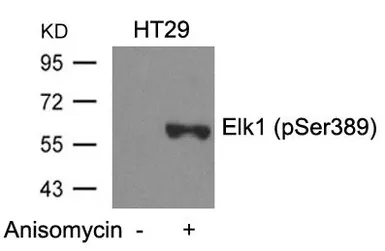 Anti-ELK1 (phospho Ser389) antibody used in Western Blot (WB). GTX50688