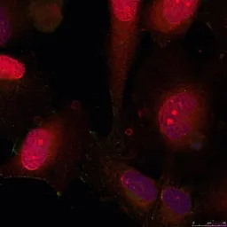 Anti-STAT3 antibody used in Immunocytochemistry/ Immunofluorescence (ICC/IF). GTX50709