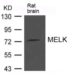 Anti-MELK antibody used in Western Blot (WB). GTX50801
