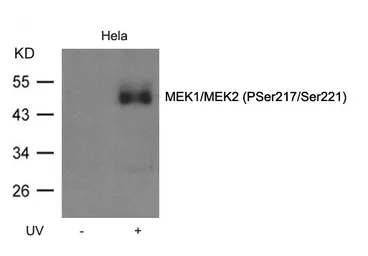 Anti-MEK1/MEK2 (phospho Ser218/Ser222) antibody used in Western Blot (WB). GTX50860