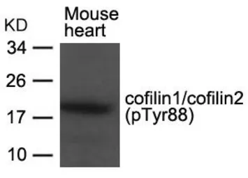 Anti-Cofilin (phospho Tyr89) antibody used in Western Blot (WB). GTX50866
