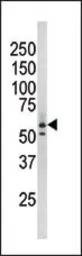 Anti-Rad9 (phospho Ser277) antibody used in Western Blot (WB). GTX50886