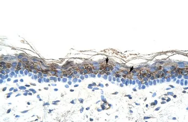 Anti-ZIC2 antibody, C-term used in IHC (Paraffin sections) (IHC-P). GTX50893