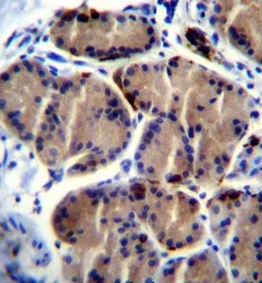 Anti-Hepatic lipase antibody used in IHC (Paraffin sections) (IHC-P). GTX50912