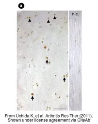 Anti-SP7 antibody, C-term used in IHC (Paraffin sections) (IHC-P). GTX50962