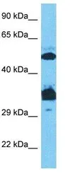 Anti-SP7 antibody, C-term used in Western Blot (WB). GTX50962