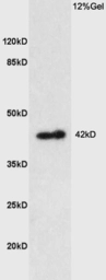 Anti-Prostaglandin E Receptor EP1 antibody used in Western Blot (WB). GTX50972