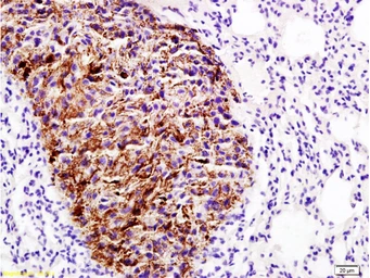 Anti-Emp1 antibody used in IHC (Paraffin sections) (IHC-P). GTX50979