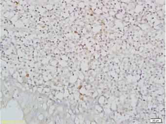 Anti-NKG2D antibody used in IHC (Paraffin sections) (IHC-P). GTX50988