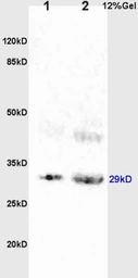 Anti-BAMBI antibody used in Western Blot (WB). GTX51308