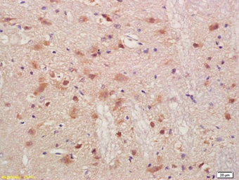 Anti-PMP2 antibody used in IHC (Paraffin sections) (IHC-P). GTX51529