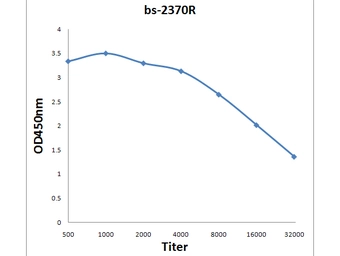 Anti-FABP5 antibody used in ELISA (ELISA). GTX51535