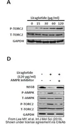 Anti-TORC2 (phospho Ser171) antibody used in Western Blot (WB). GTX51565