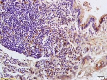 Anti-LONP1 antibody used in IHC (Paraffin sections) (IHC-P). GTX51596