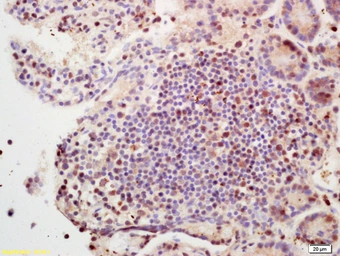 Anti-SETBP1 antibody used in IHC (Paraffin sections) (IHC-P). GTX51616