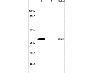 Anti-DNAJB4 antibody used in Western Blot (WB). GTX51675