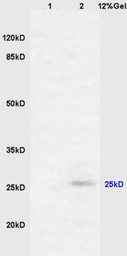 Anti-RASSF3 antibody used in Western Blot (WB). GTX51688