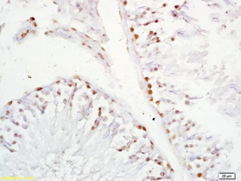 Anti-XAGE2 antibody used in IHC (Paraffin sections) (IHC-P). GTX51780