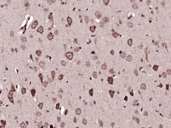Anti-SPON1 antibody used in IHC (Paraffin sections) (IHC-P). GTX51796