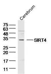 Anti-SIRT4 antibody used in Western Blot (WB). GTX51798