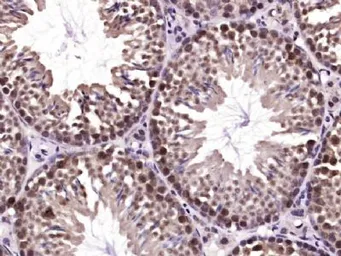 Anti-SHARPIN antibody used in IHC (Paraffin sections) (IHC-P). GTX52193