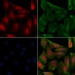 Anti-FOXO1 (phosphoThr24) + FOXO3a (phospho Thr32) + FOXO4 (phospho Thr28) antibody used in Immunocytochemistry/ Immunofluorescence (ICC/IF). GTX52338