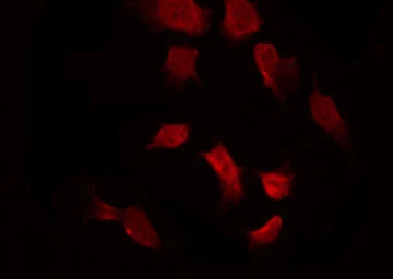 Anti-AMPK alpha 1 (phospho Thr183) + AMPK alpha 2 (phospho Thr172) antibody used in Immunocytochemistry/ Immunofluorescence (ICC/IF). GTX52341