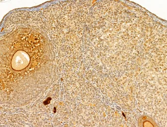 Anti-AMPK alpha 1 (phospho Thr183) + AMPK alpha 2 (phospho Thr172) antibody used in IHC (Paraffin sections) (IHC-P). GTX52341