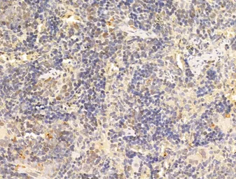 Anti-AMPK alpha 1 (phospho Thr183) + AMPK alpha 2 (phospho Thr172) antibody used in IHC (Paraffin sections) (IHC-P). GTX52341