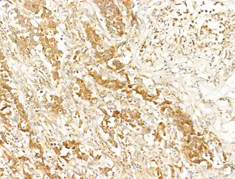 Anti-AMPK alpha 1 (phospho Thr183) + AMPK alpha 2 (phospho Thr172) antibody used in IHC (Paraffin sections) (IHC-P). GTX52341