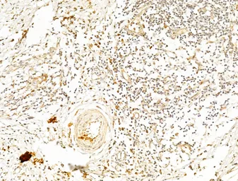 Anti-AMPK alpha 1 (phospho Thr183) + AMPK alpha 2 (phospho Thr172) antibody used in IHC (Paraffin sections) (IHC-P). GTX52341