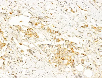 Anti-AMPK alpha 1 (phospho Thr183) + AMPK alpha 2 (phospho Thr172) antibody used in IHC (Paraffin sections) (IHC-P). GTX52341
