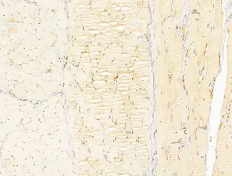 Anti-AMPK alpha 1 (phospho Thr183) + AMPK alpha 2 (phospho Thr172) antibody used in IHC (Paraffin sections) (IHC-P). GTX52341