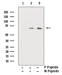 Anti-AMPK alpha 1 (phospho Thr183) + AMPK alpha 2 (phospho Thr172) antibody used in Western Blot (WB). GTX52341